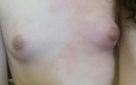 My nipples, maltreated this afternoon by a relentless gentleman.... 1 tumblr p4zh0cl2MN1viv7dyo1 500 1