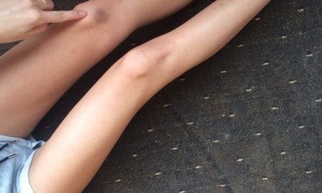 Welts and bruises … my last Man wanted it pretty rough.... 8