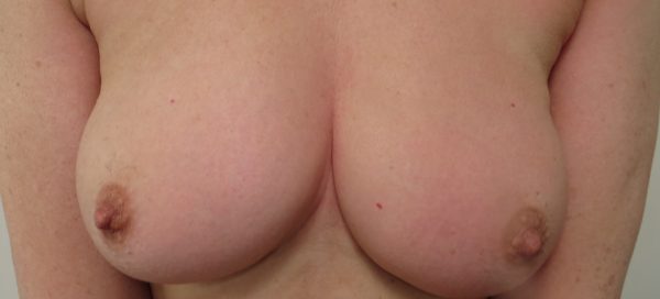 Modest First Sun #Boobday 309 3